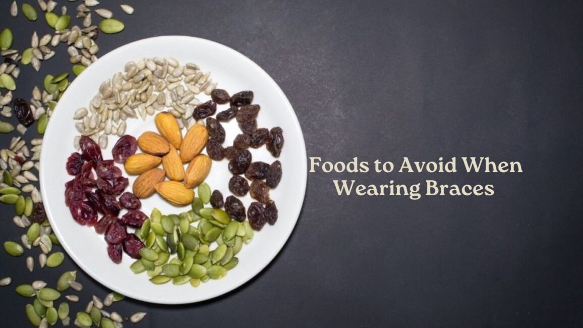 Foods to Avoid When Wearing Braces