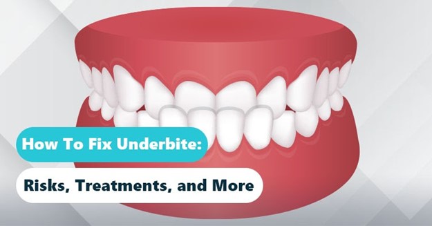 How To Fix Underbite: Treatment Options From Braces to Underbite Surgery
