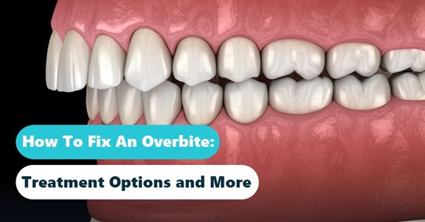 How To Fix An Overbite: Clear Aligners, Braces & Other Options