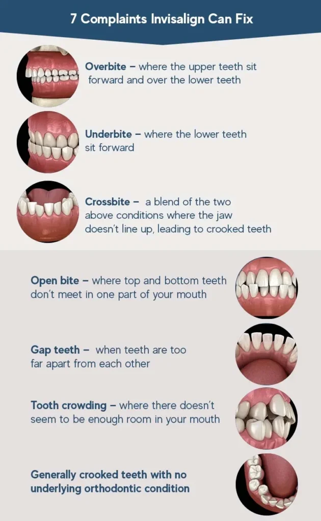 7 complaints Invisalign Can Fix